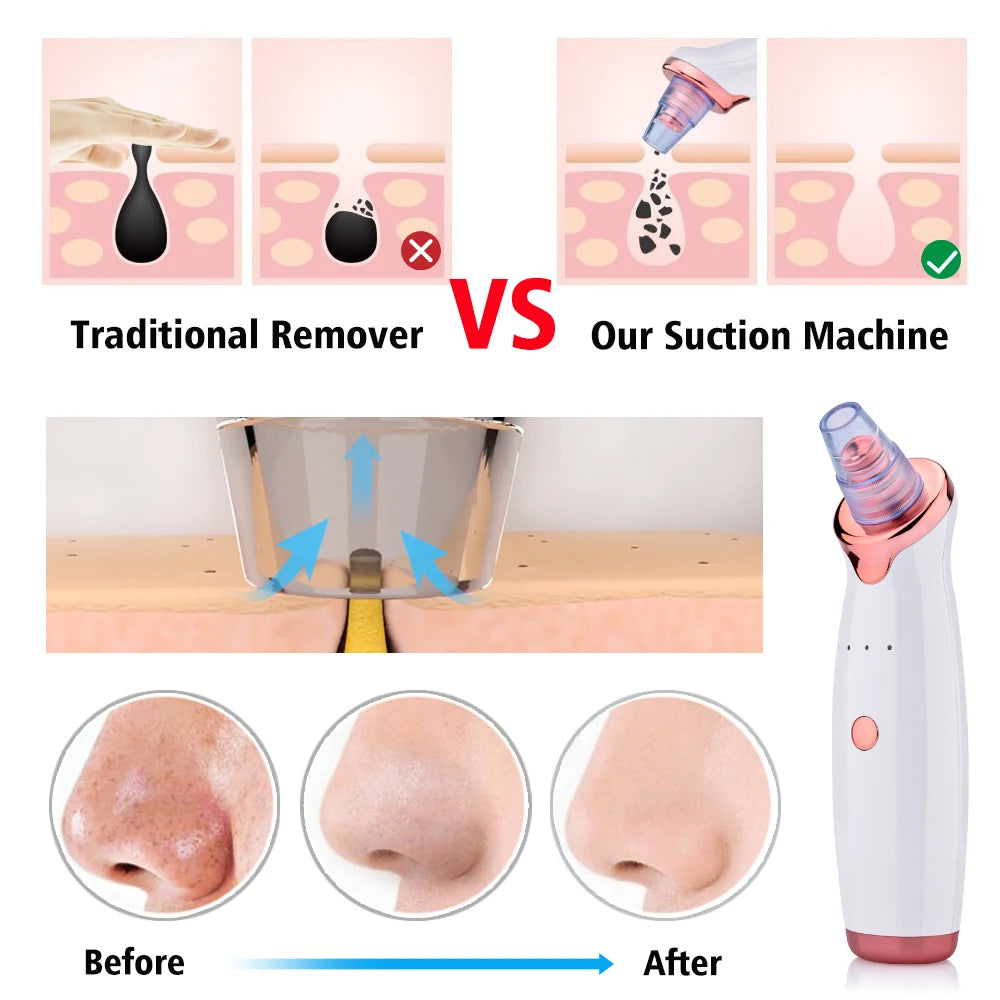 Electric Facial Blackhead Remover Vacuum Pore Cleaner Acne Cleanser Black Spots Removal Face Nose Deep Facial Cleaning Tools